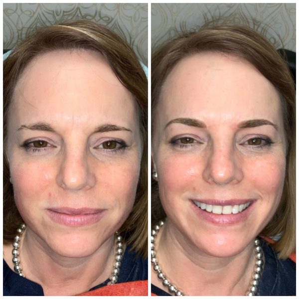 Digital Eyebrow Microblading