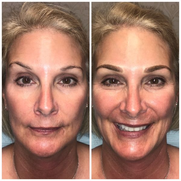 Permanent Eyebrows Manual and digital Microblading